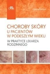 Skin diseases in elderly patients - a practical guide for the family doctor