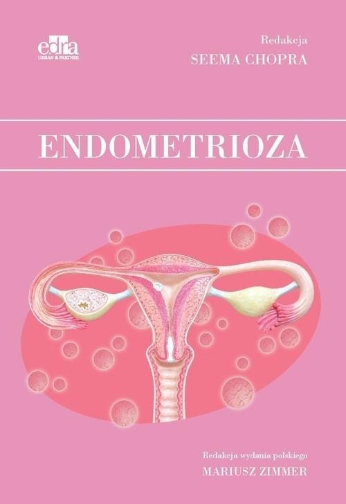 Endometrioza - S Chopra