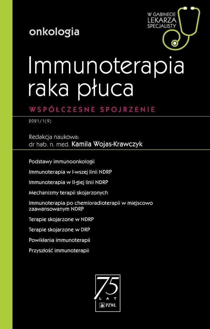 Immunotherapy of lung cancer - Kamila Wojas-Krawczyk - discover modern treatment methods