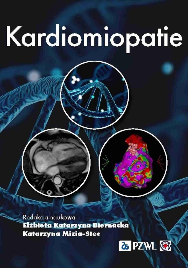 Cardiomyopathies - Elżbieta Katarzyna Biernacka, Katarzyna Mizia-Stec - book about heart diseases