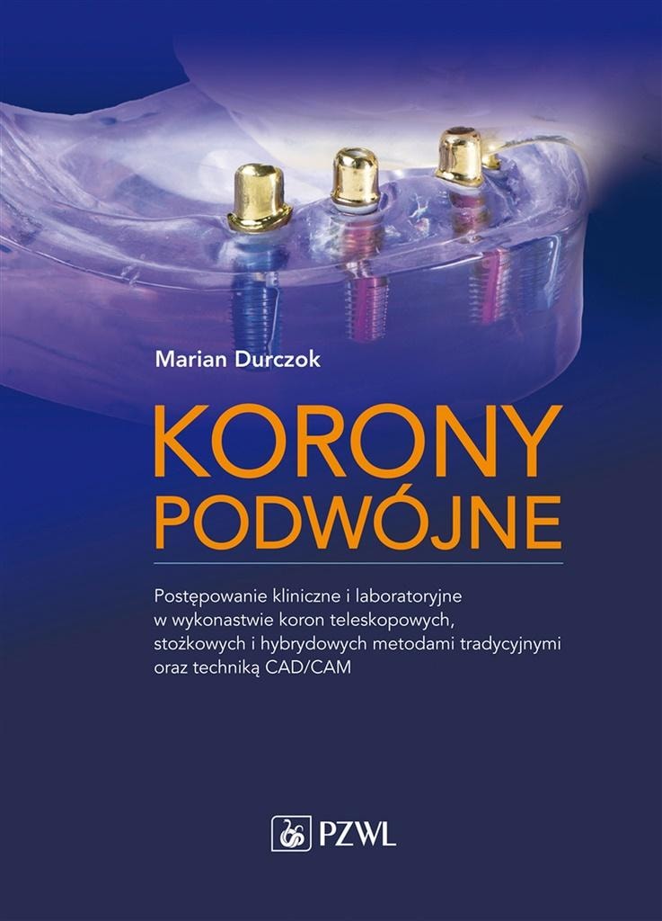 Marian Durczok - Double Crowns - a practical prosthetic handbook