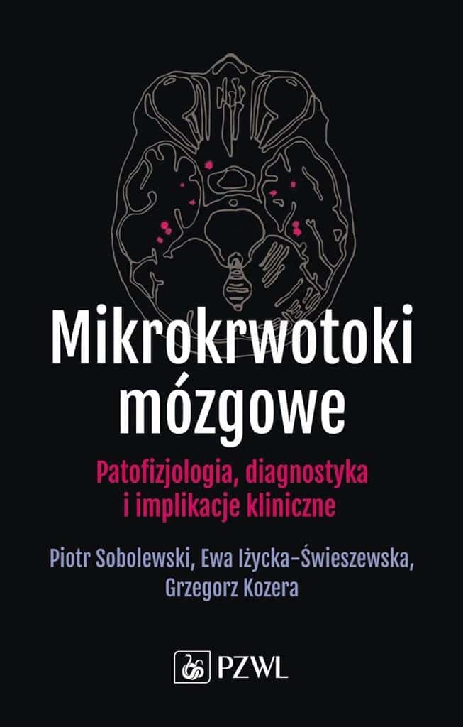 Cerebral microbleeds: Piotr Sobolewski, Ewa Iżycka-Świeszewska, Grzegorz - comprehensive knowledge