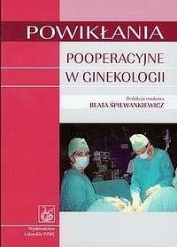 Postoperative complications in gynecology - Beata Śpiewankiewicz - comprehensive overview