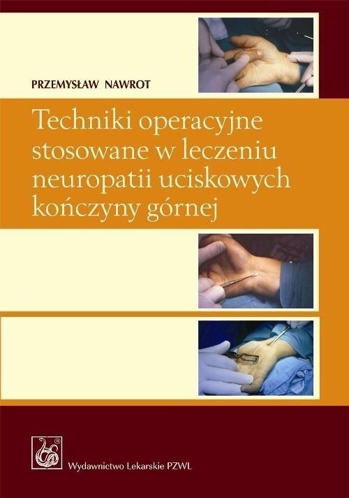 Surgical techniques in the treatment of limb neuropathies - Przemysław Nawrot